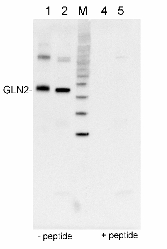 Western blot detection using anti-GLN2 antibodies